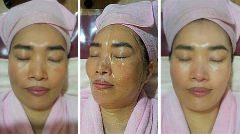 将面膜涂抹于半张脸后对皮肤变化状况进行了比较。