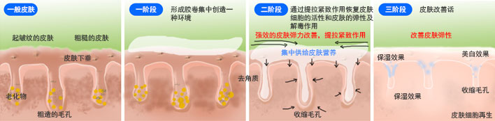 Adela Super Lifting Pack